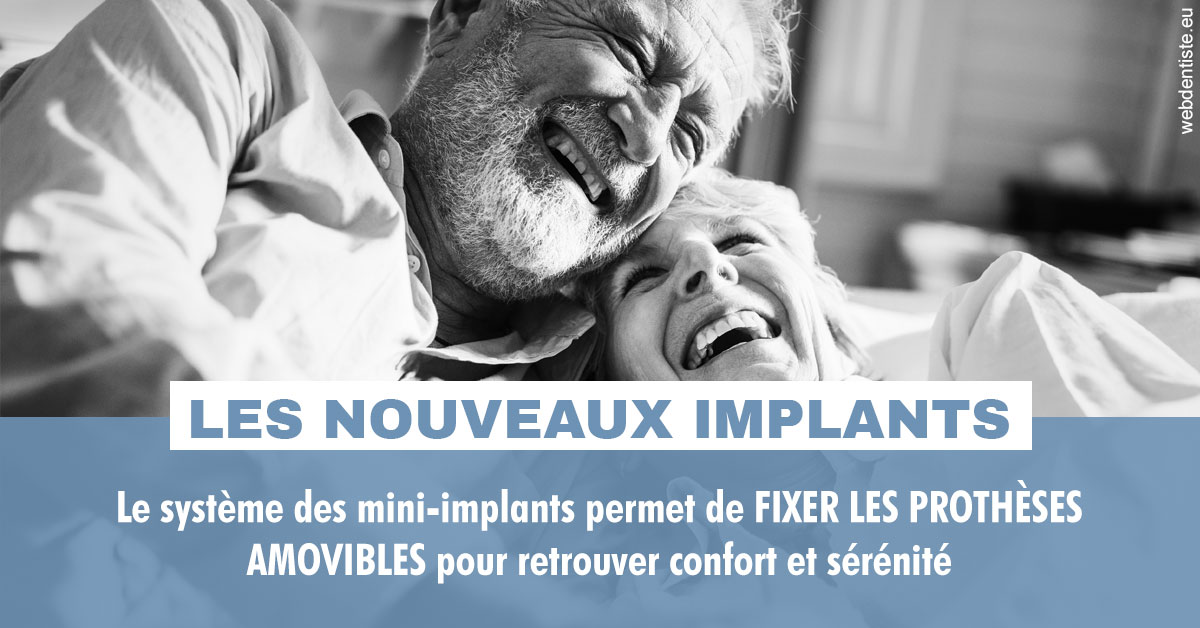 https://www.cabinetorthodontie.fr/Les nouveaux implants 2