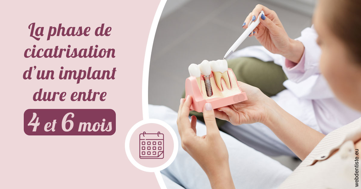 https://www.cabinetorthodontie.fr/Cicatrisation implant 2