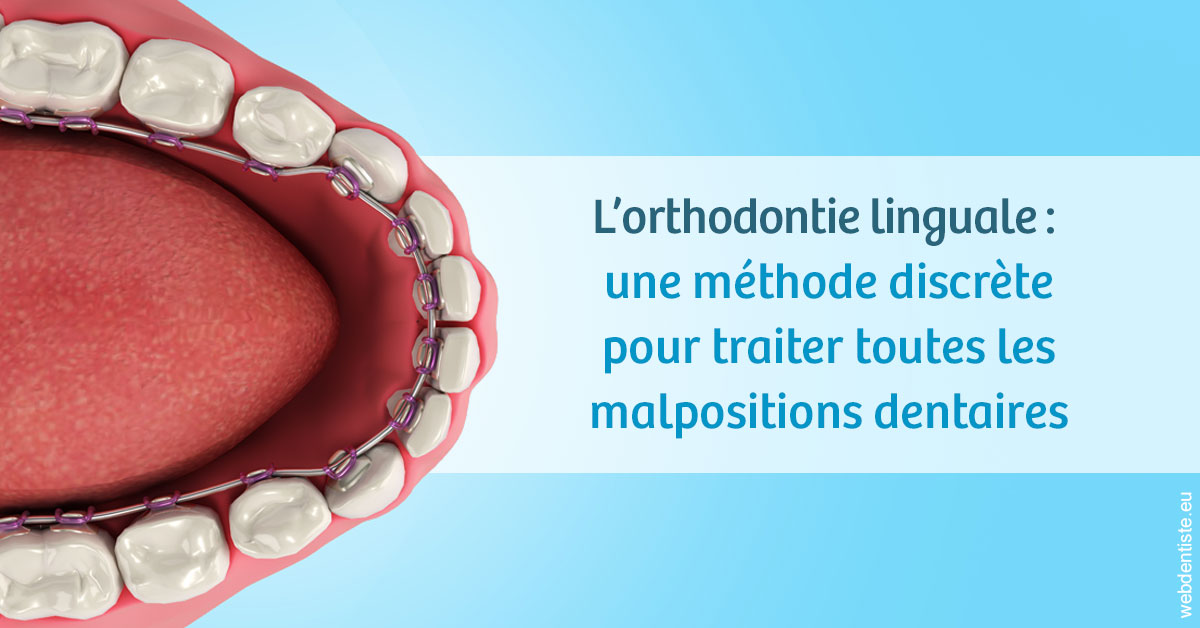 https://www.cabinetorthodontie.fr/L'orthodontie linguale 1