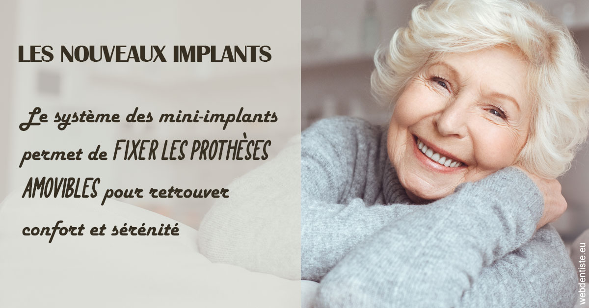 https://www.cabinetorthodontie.fr/Les nouveaux implants 1