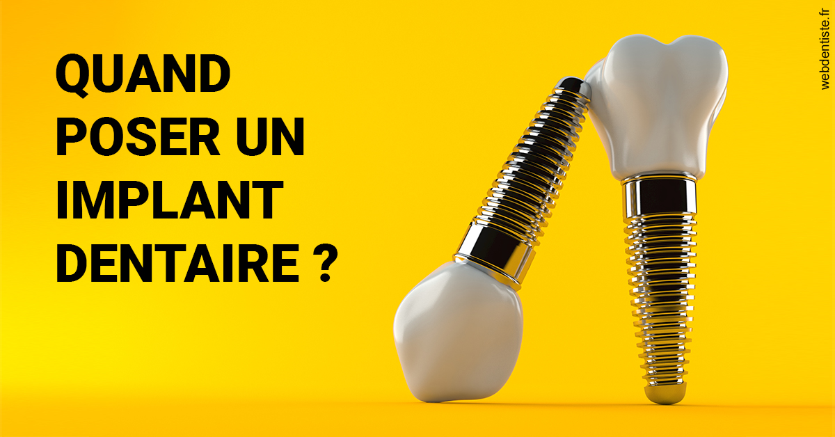 https://www.cabinetorthodontie.fr/Les implants 2