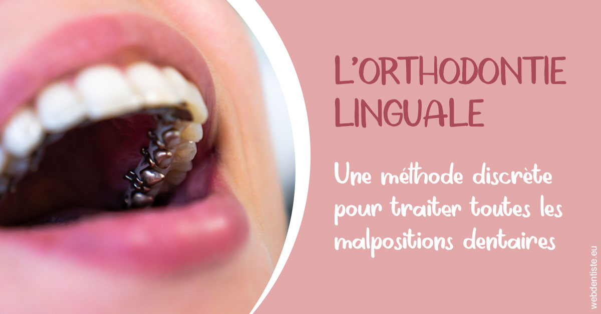 https://www.cabinetorthodontie.fr/L'orthodontie linguale 2