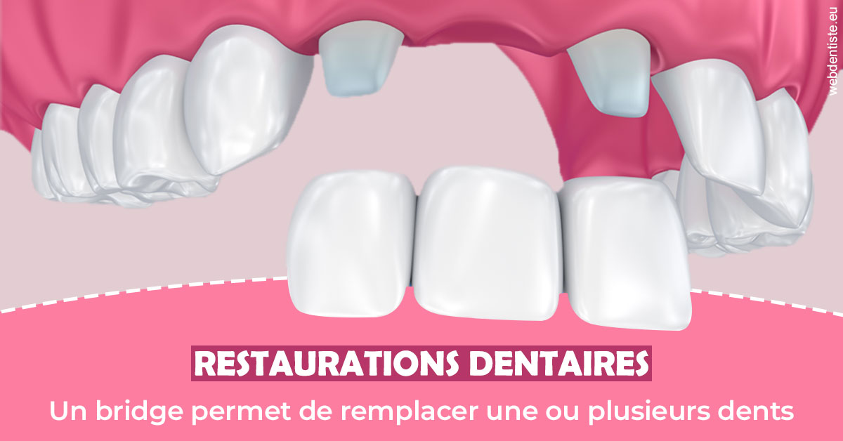 https://www.cabinetorthodontie.fr/Bridge remplacer dents 2