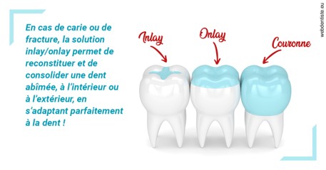 https://www.cabinetorthodontie.fr/L'INLAY ou l'ONLAY