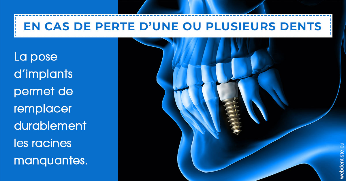 https://www.cabinetorthodontie.fr/2024 T1 - Implants 01