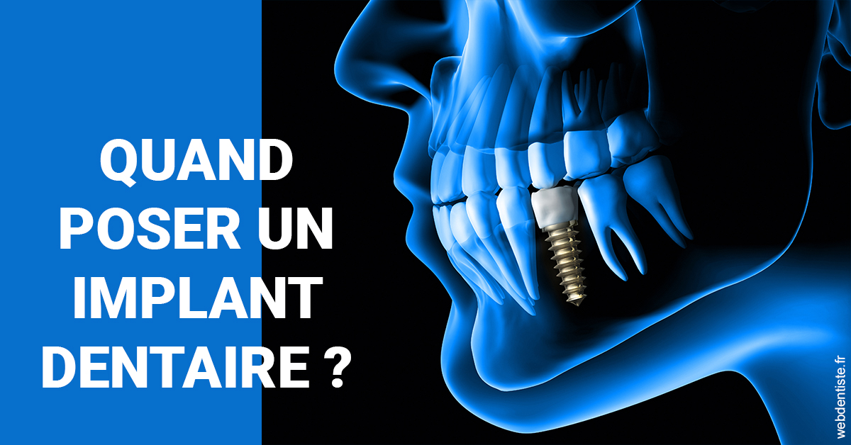 https://www.cabinetorthodontie.fr/Les implants 1