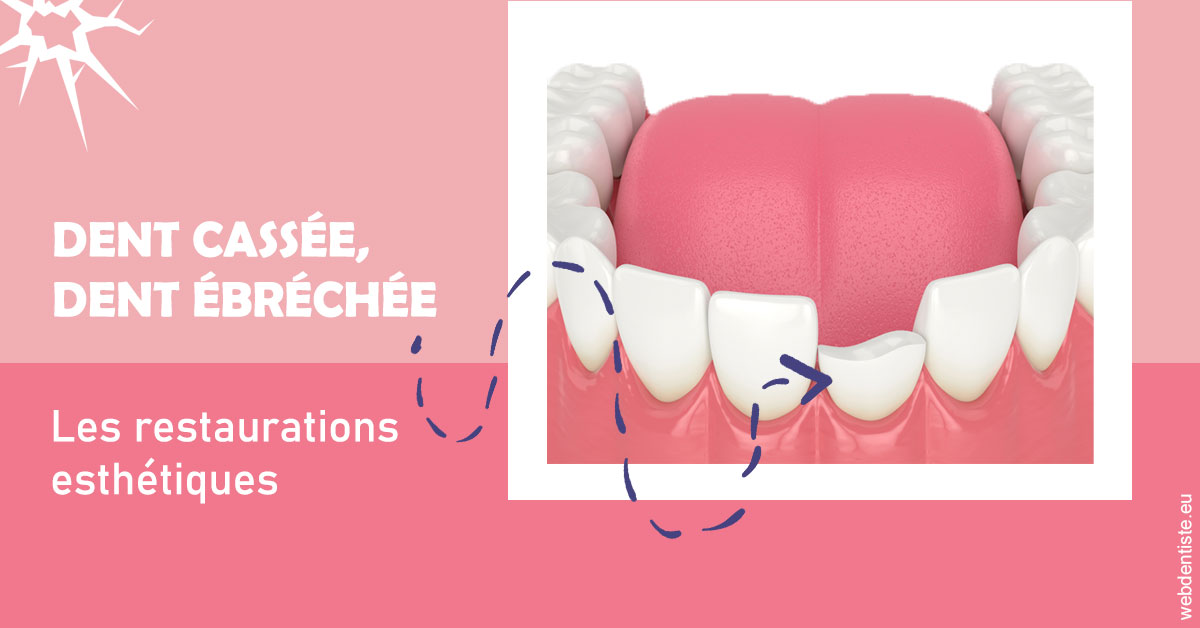 https://www.cabinetorthodontie.fr/Dent cassée ébréchée 1