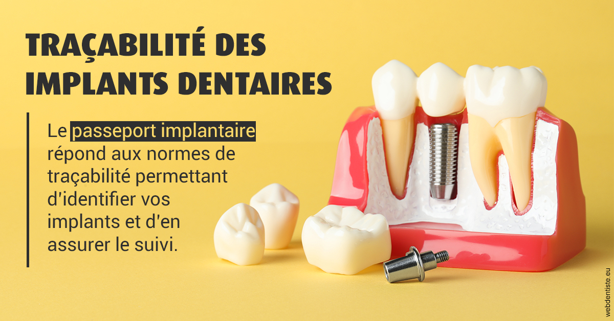 https://www.cabinetorthodontie.fr/T2 2023 - Traçabilité des implants 2