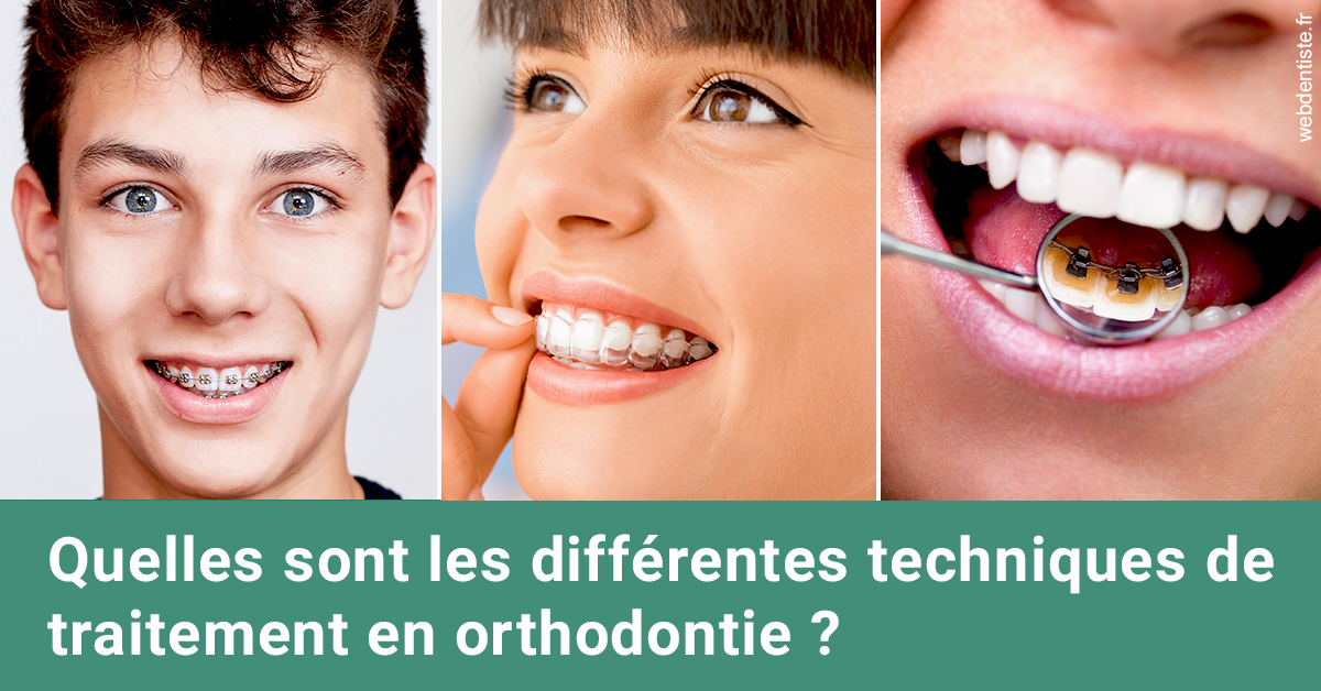 https://www.cabinetorthodontie.fr/Les différentes techniques de traitement 2