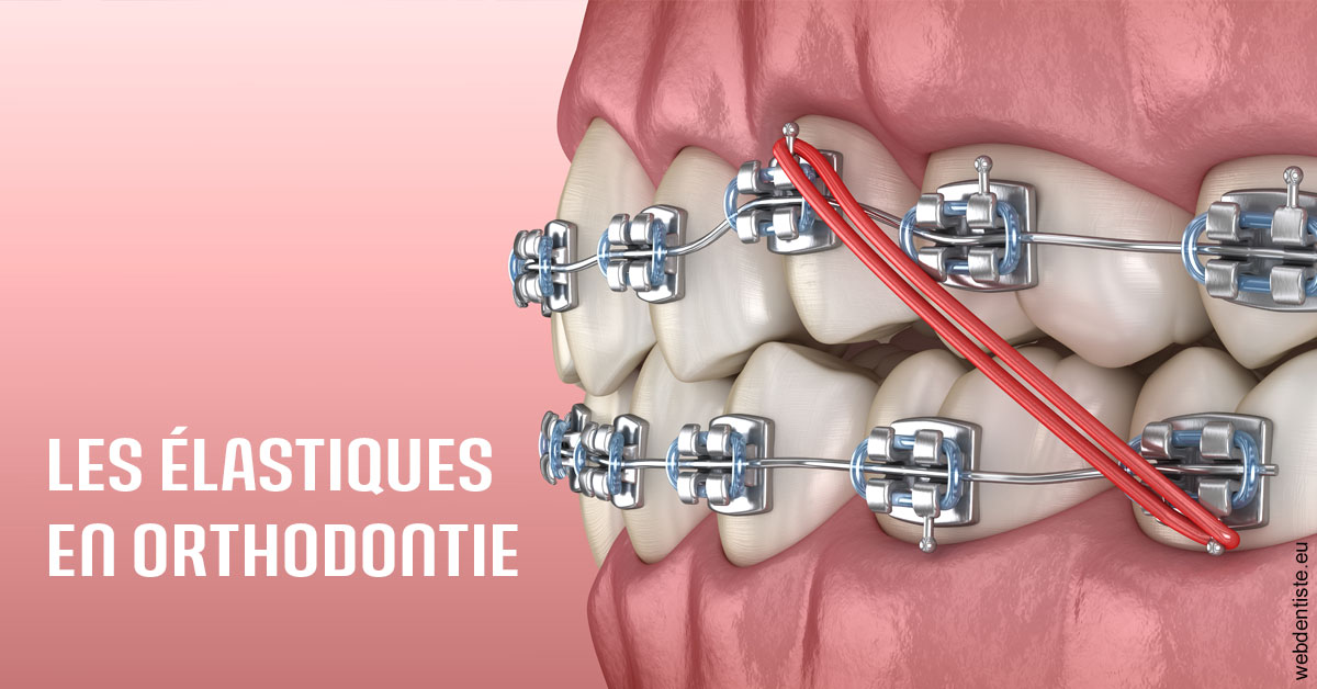 https://www.cabinetorthodontie.fr/Elastiques orthodontie 2