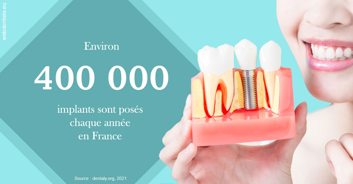 https://www.cabinetorthodontie.fr/Pose d'implants en France 2