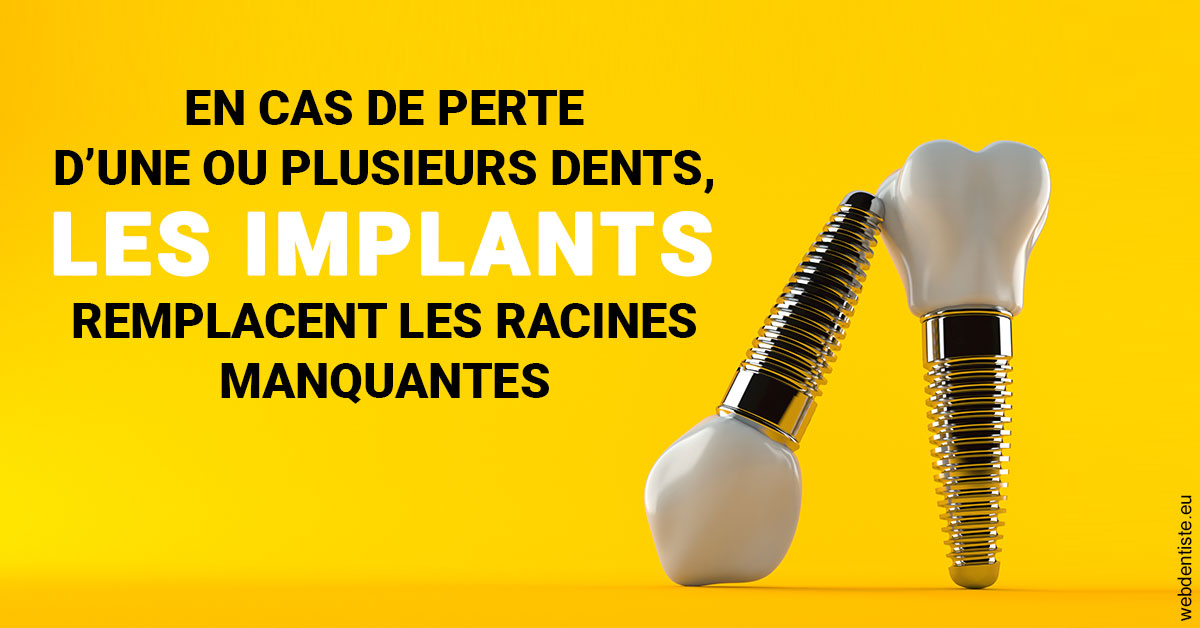 https://www.cabinetorthodontie.fr/Les implants 2