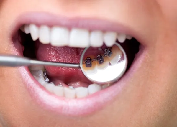 Orthodontie