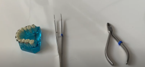 Que faire si le fil orthodontique se casse