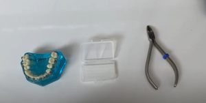 Que faire si un boitier orthodontique se casse et que ça gêne?